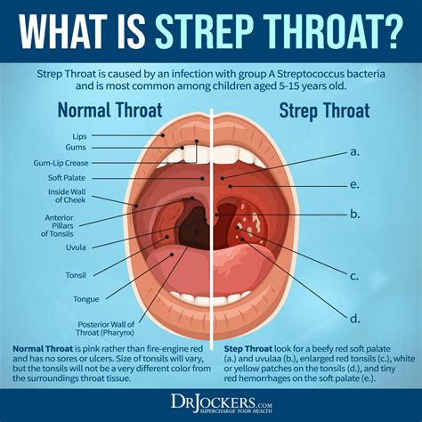 THROAT .
